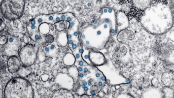 CDC image showing Transmission electron microscopic image of an isolate from the first U.S. case of COVID-19, formerly known as 2019-nCoV. The spherical viral particles, colorized blue, contain cross-sections through the viral genome, seen as black dots.